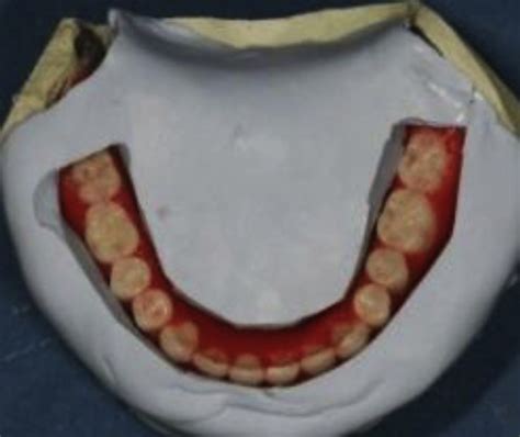 The Teeth Were Arranged Within The Neutral Zone Download Scientific