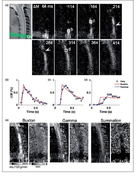 Figure From Optimized Cervical Spinal Cord Perfusion Mri After