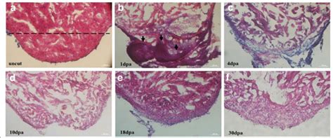 Different phenotypes of injured zebrafish heart. The stages of heart ...