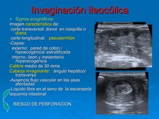 Invaginaci N Intestinal Ppt