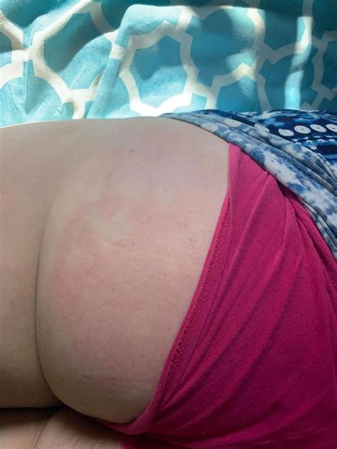 Sexydixie He Left A Handprint Nude Pics Xhamster