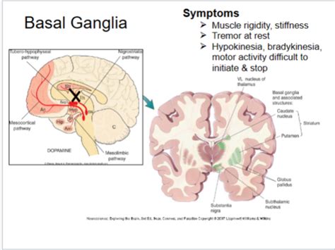 Neuro Parkinson S Disease Pathology And Treatment Flashcards Quizlet