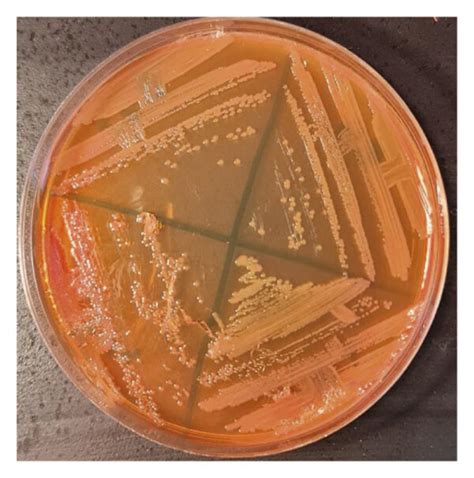 A Red Colonies Of A Baumannii On CHROMagar Acinetobacter Agar B