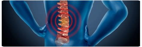 Got Back Pain Burquitlam Physiotherapy