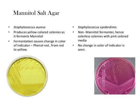 Mannitol Salt Agar