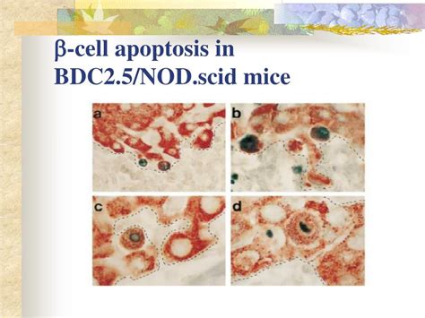 PPT Cell Apoptosis In T Cell Mediated Autoimmune Diabetes PowerPoint