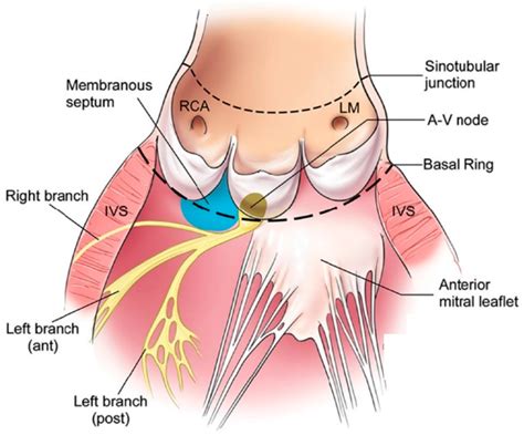 Jcdd Free Full Text Contemporary Evaluation And Clinical Treatment