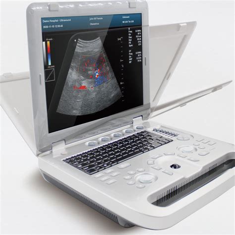 Contec Handheld Smart And Light Slim Design Easy Scan Vet Ultrasound