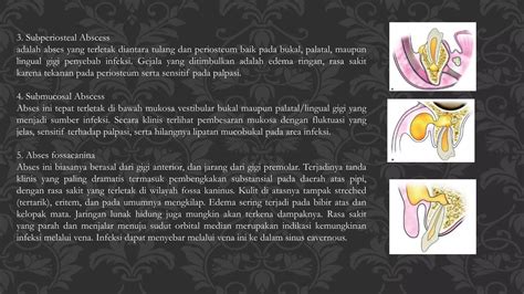 Insisi Abses Drgharijadi Pptx