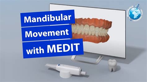 Mandibular Movement With Medit Youtube