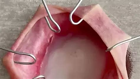 Penis Self Torture Gay Man Man Porn Xhamster