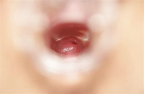 Zoe And Her Cervix Porn Pictures XXX Photos Sex Images PICTOA