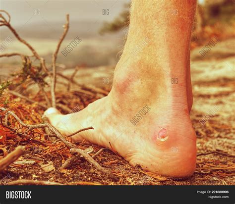 Mens Naked Feet Cheap Sale Emergencydentistry