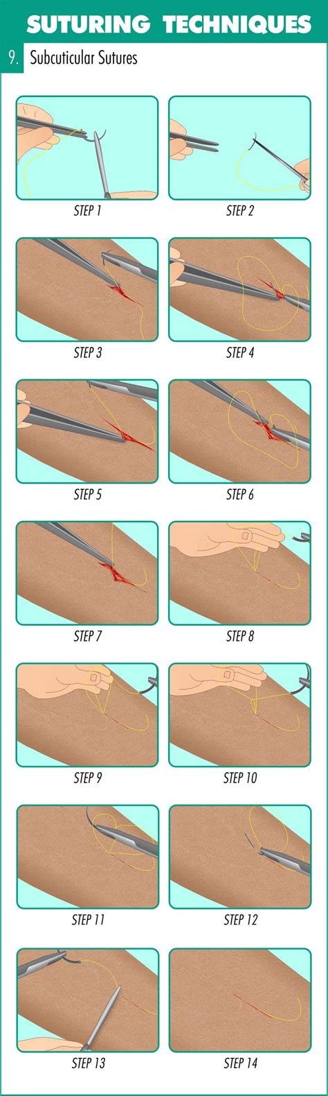 Complete Guide To Mastering Suturing Techniques
