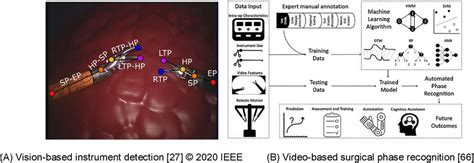 Examples Of Surgical Video Analysis Techniques Including Detection