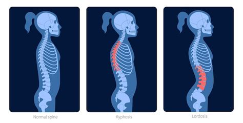 vertebral body anatomy vectors illustrations