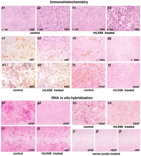 Immunohistochemical Observations And Rna In Situ Hybridization Analysis