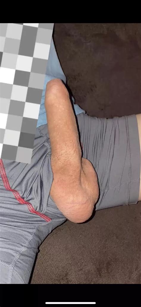 Id Let You Pull My Foreskin Down Nudes Foreskin Nude Pics Org