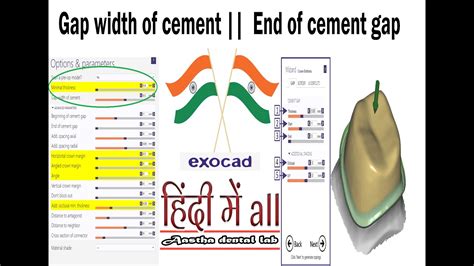 Gap Width Of Cement Exocard End Of Cement Gap Exocad Crown Design