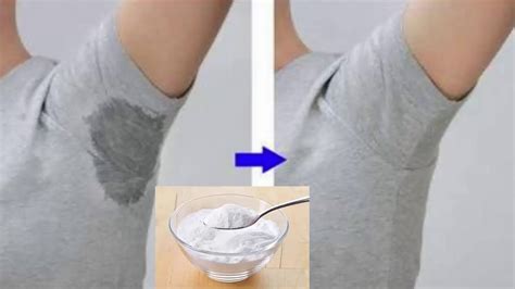 How To Stop Underarm Sweating Permanently Youtube