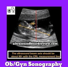 Ob Gyn Sonography Registry Review Ideas Sonography Ultrasound