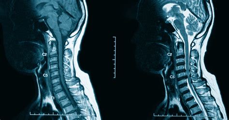 What Is An Mri With Contrast Envision Radiology