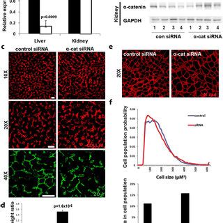 Specific Knockdown Of Catenin In Liver Induces Major Alterations To