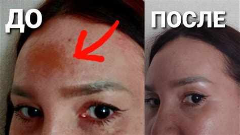 Лучший Отбеливающий Корейский Крем Melaban от Meditime отзывы - YouTube