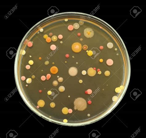 Morfologia Microscopica Y Macroscopica