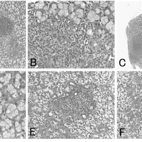 Histopathology Of The Lacrimal And Salivary Glands From Thymectomized