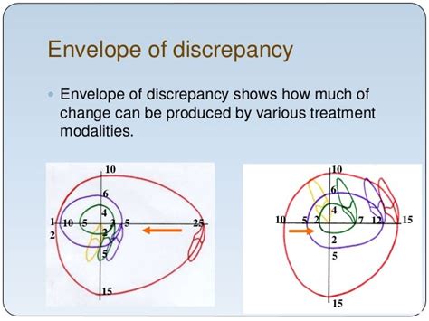 Diagnosis and treatment planning in Orthognathic Surgery