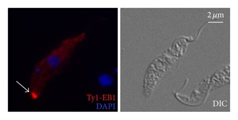 Subpellicular Microtubule Plus End Dynamics Revealed By Eb Cells