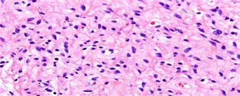 histopathological picture  tumour tissue  scientific diagram