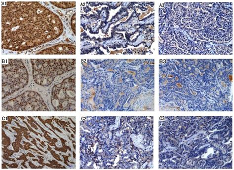 Immunohistochemical Evaluation Of Er Pr Her Neu In Mouse And