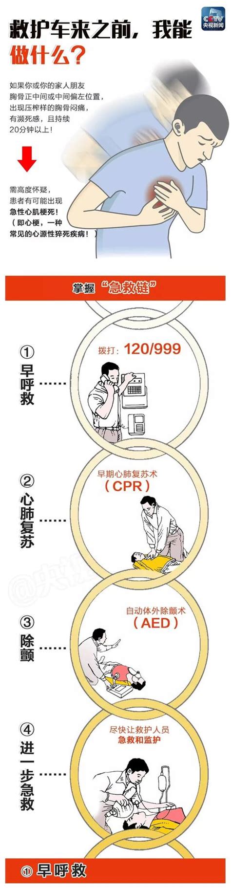 什么是心源性猝死？是什么原因引起？出现症状如何进行抢救呢？ 知乎