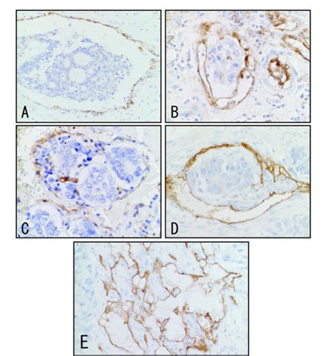 Representative Photomicrographs Of Intravascular Tumor Endothelial