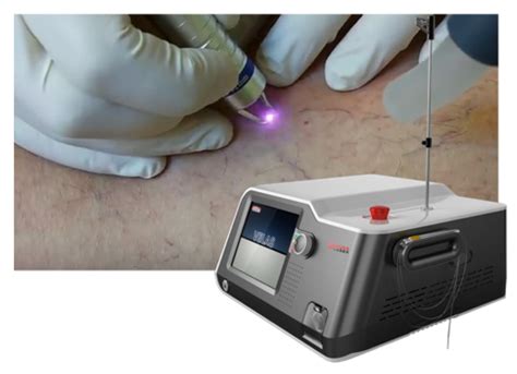 Vaskulární laser