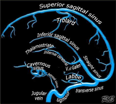 Venous drainage of Brain... (Vein of Galen = Great cerebral vein