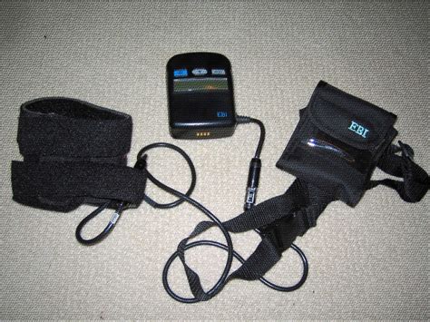 Bone Healing With Ebi Bone Growth Stimulator Hubpages