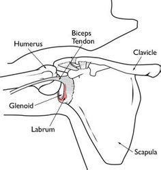 Shoulder Labrum SLAP Tear: Causes, Symptoms, Diagnosis, Treatment | Labral tear shoulder, Torn ...