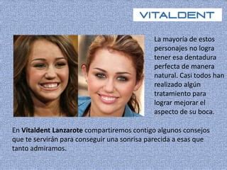 Vitaldent Lanzarote Como Consiguen Los Famosos Una Dentadura Perfecta