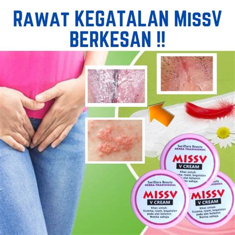 Cara Merawat Gatal Pada Kemaluan Wanita 100 ORIGINAL KRIM MISS V