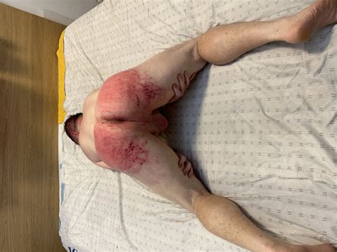 My Ass Being Whipped By My Master Pics Xhamster