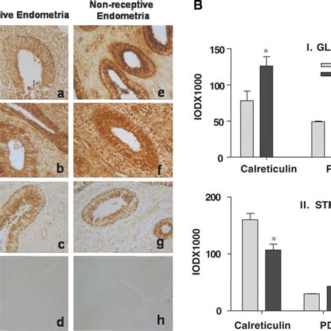 Histomorphological Features Of Receptive Endometria From Download