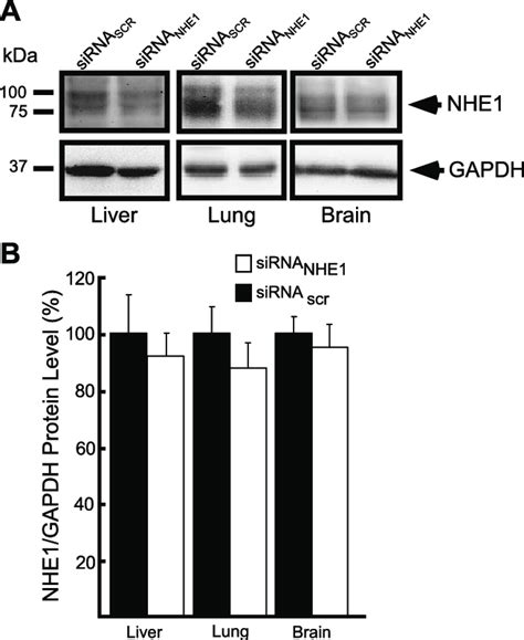 NHE1 Protein Expression In Mouse Liver Lung And Brain Mice Were