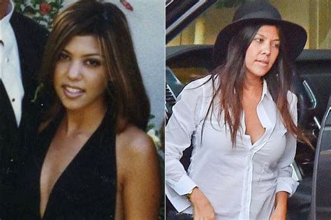 Most Shocking Boob Jobs Surgical Procedures Mirror Online