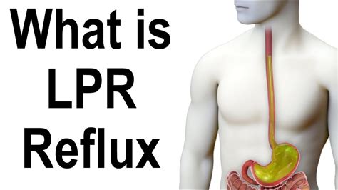 What Is Lpr Laryngopharyngeal Reflux Acidic And Non Acidic Throat