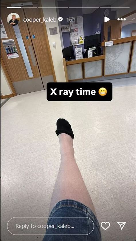 current picture of kaleb from shriners hospital 2