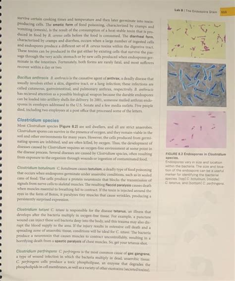Solved he endospore stain is an example of a structural | Chegg.com