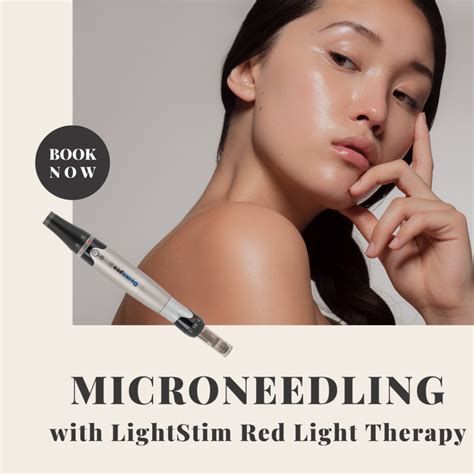 The Ultimate Guide To Microneedling Rejuvenate Your Skin And Boost